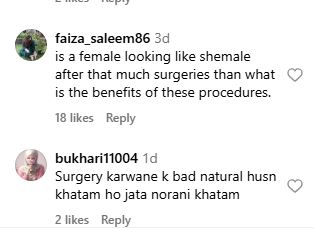 Nadia Hussain’s Backlash - Beauty Transformation or Botox Blunder? 3 Nadia Hussain’s Backlash - Beauty Transformation or Botox Blunder?