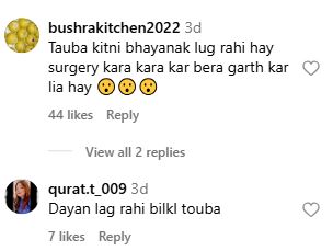 Nadia Hussain’s Backlash - Beauty Transformation or Botox Blunder? 2 Nadia Hussain’s Backlash - Beauty Transformation or Botox Blunder?