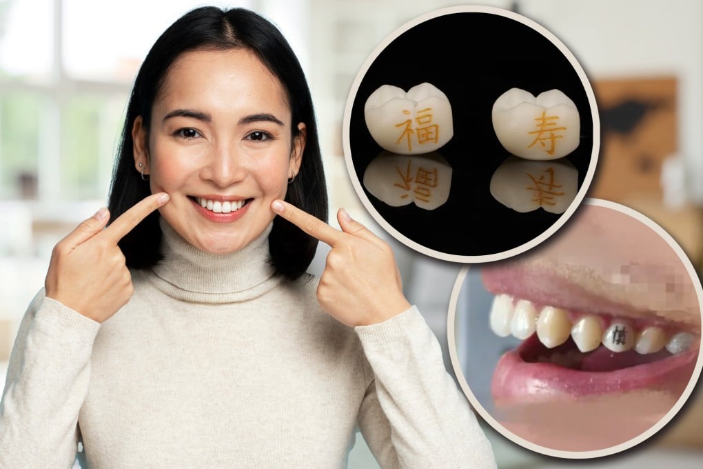 Tooth Tattoos Viral Trend in China Opens — Beauty Trend or Dental Disaster?
